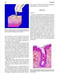 article2